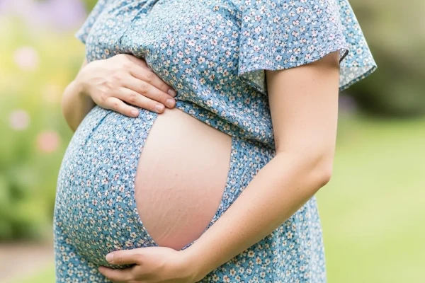 Cara Menghilangkan Stretch Mark: 7 Panduan Lengkap Terbaik untuk Kulit Mulus Kembali Wanita memegang perut dengan stretch mark ibu hamil